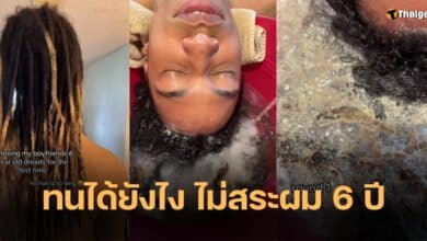 หนุ่มไม่สระผม 6 ปี