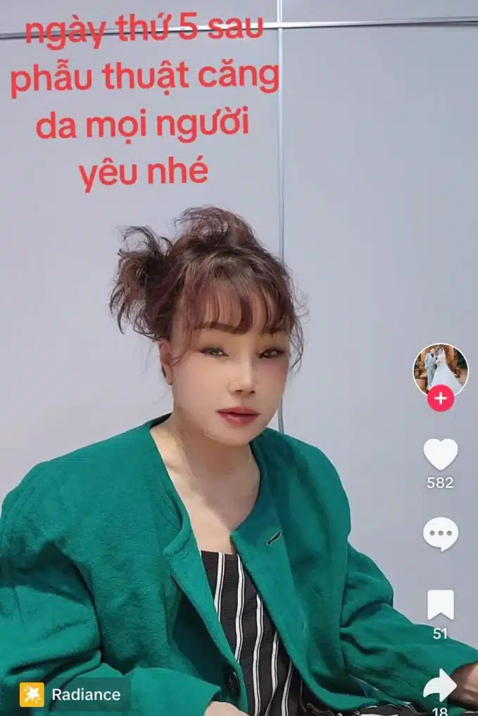 เจ้าสาวอายุ 62 ลงทุนดึงหน้า โมใหม่แทบจำไม่ได้ หวังเซอร์ไพรส์สามีเด็ก