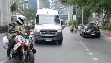 เด็ก 7 เดือน ผ่าตัดหัวใจ