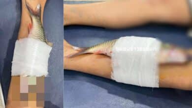 เบ็ดเกี่ยวขาเด็ก ขอปลาคืนนำเด้อครับ