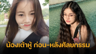 เปิดภาพ น้องเต้าหู้ Aurora ก่อน-หลังศัลยกรรม