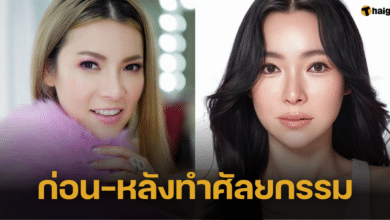 เปิดภาพความสวย 'ต้นหอม' ก่อนและหลังทำศัลยกรรม สวยเป๊ะประหนึ่งสาวเกาหลี