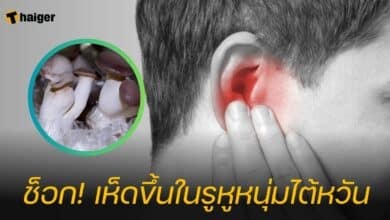 เห็ดขึ้นในรูหู