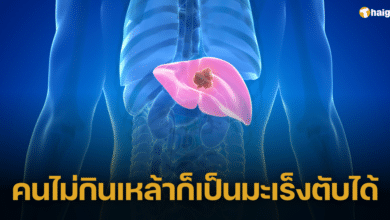 แพทย์ ชี้ คนแข็งแรงก็เป็นมะเร็งตับได้ หลังคนไข้ไม่ดื่มเหล้า แต่เสียชีวิตเพราะมะเร็ง