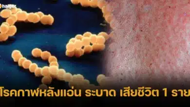 โรคกาฬหลังแอ่น ระบาด เสียชีวิต 1 ราย