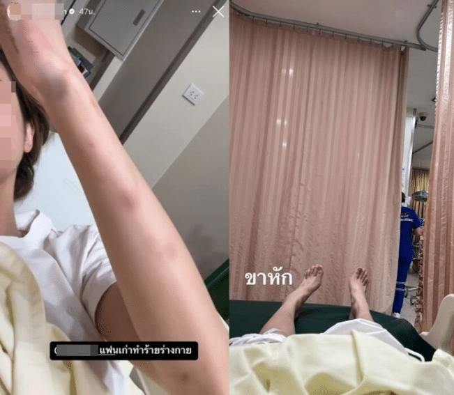 สาวแฉ นักแสดง gmm ทำร้ายร่างกาย