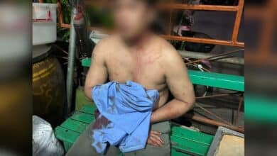 ชายถูกเมียตีหัวเจ็บ