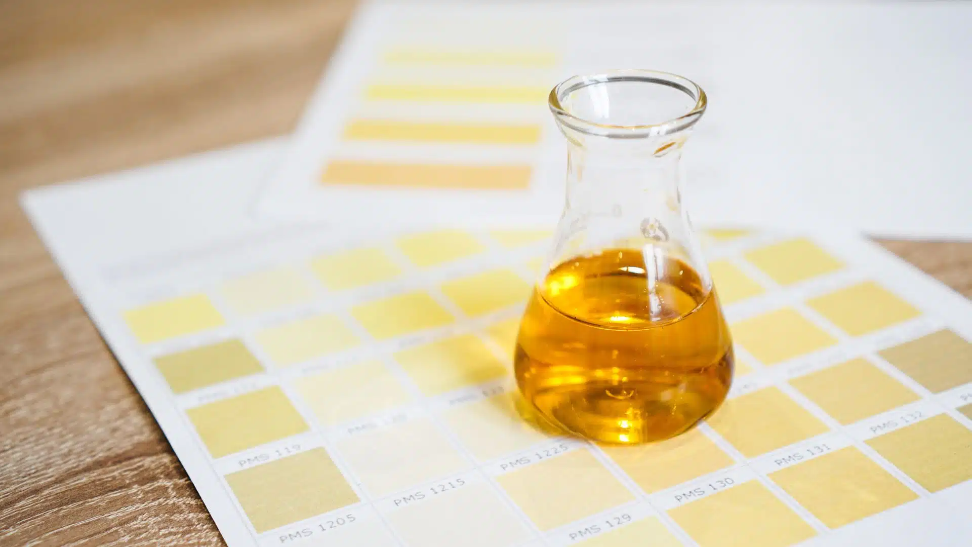 ตรวจสอบสีปัสสาวะของคุณ