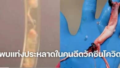 พบแท่งย้วยสีขาว ในคนฉีดวัคซีนโควิด