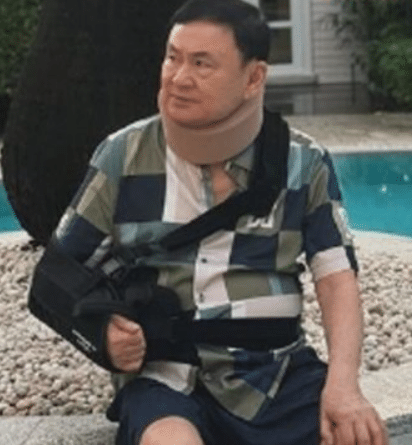 อาการทักษิณล่าสุด