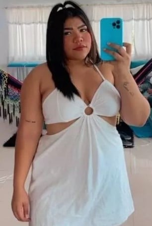 เสียชีวิตหลังผ่าตัดเสริมก้น