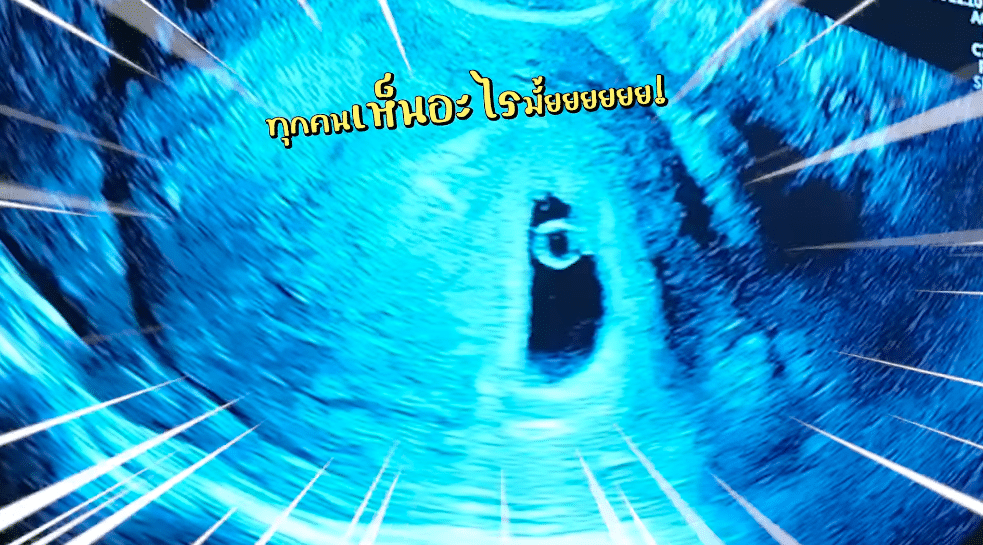 แฝดหรือไม่ 'แพตตี้-แดน' เผยคลิปนาทีรู้ว่าท้อง พร้อมทิ้งปริศนาชวนสงสัย &quot;มี 2 ถุง&quot;