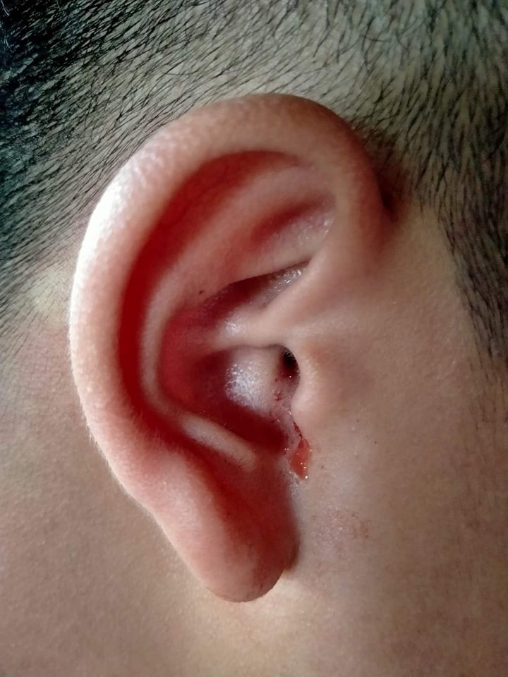 ครูตบนักเรียน ม.1 หูทะลุ