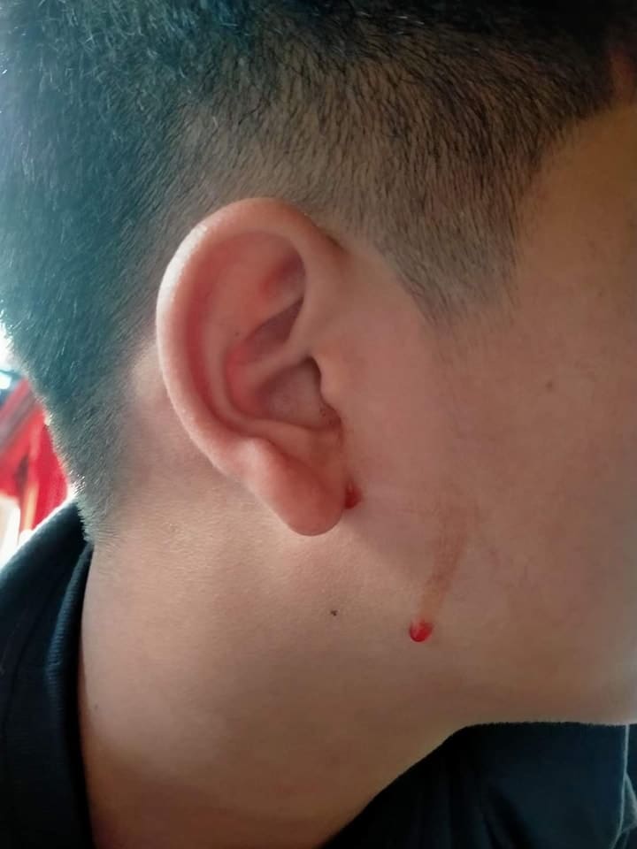 ครูตบนักเรียน แก้วหูทะลุ