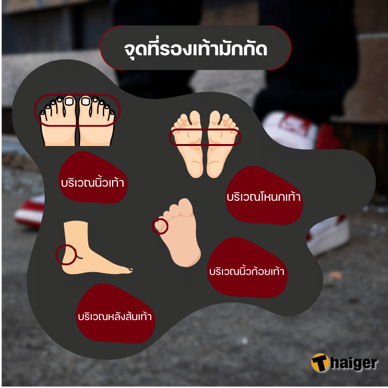 จุดที่รองเท้ามักกัด