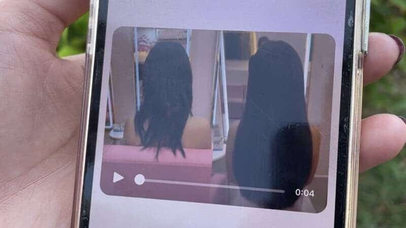 ดราม่า ต่อผมแล้วผมร่วง โหนกระแส