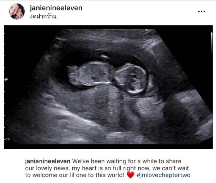 ย้อนเส้นทางรัก เจนี่-มิกกี้