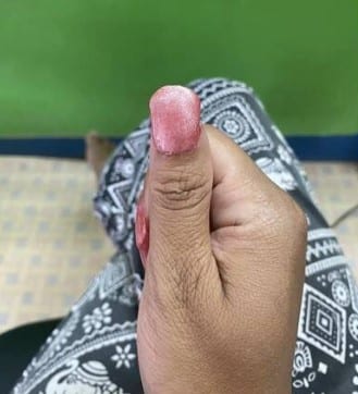 ลูกค้ารับไม่ได้ ทำเล็บ1400 สภาพยับเยิน