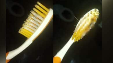 ลูกตะขาบในแปรงสีฟัน