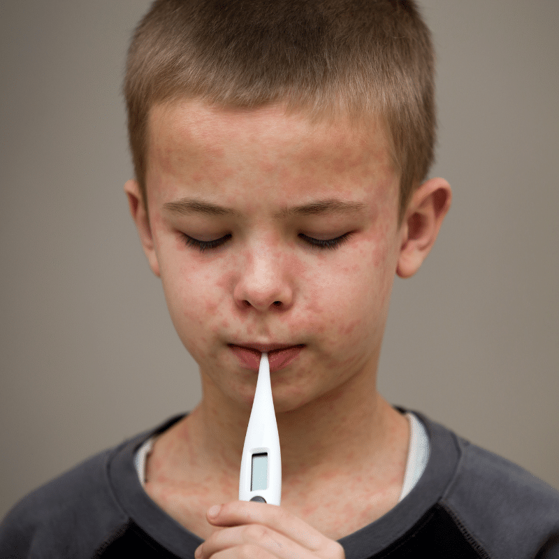 วิธีป้องกันโรคหัด