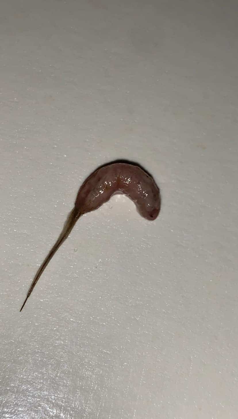 หนอนในน้ำดื่ม