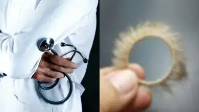 ขอบตาแพะ