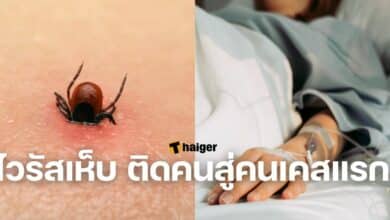 ไวรัสเห็บ ติดคนสู่คนเคสแรก