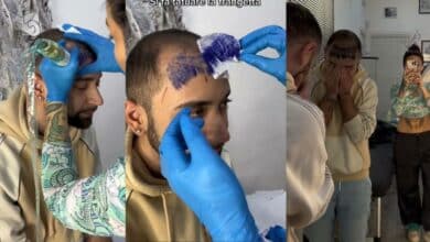 Balding-man-gets-fringe-tattooed