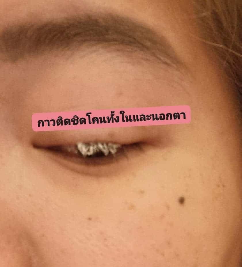 ข่าวต่อขนตาแล้วฟ้องร้องร้าน