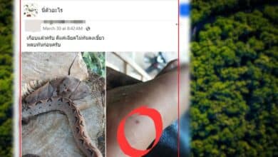 ไวรัลหนุ่มโพสต์โดนงูกัด