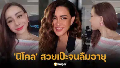นิโคล เทริโอ ทำศัลยกรรมย้อนวัย