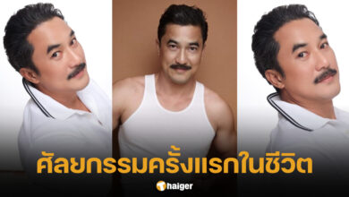 วิทย์ ภูธฤทธิ์ ศัลยกรรมครั้งแรก