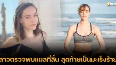 สาวตรวจพบแผลที่ลิ้น สุดท้ายเป็นมะเร็งร้าย คร่าชีวิต