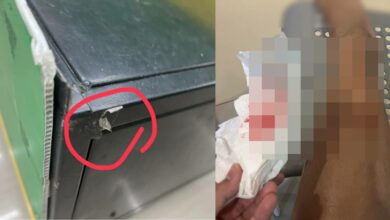 สาวเข้าร้านสะดวกซื้อได้แผล