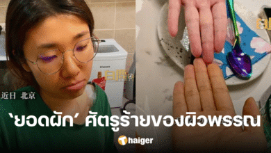 A woman's skin turned orange after eating carrots for three months to lose weight! A trick from medical education to come back in vain
