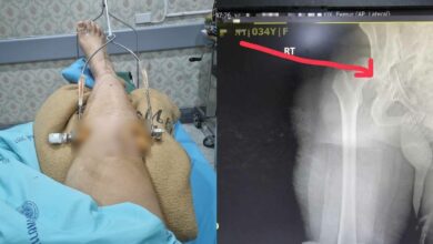 ข่าวพยาบาลรีเฟอร์ ส่งตัวผู้ป่วย