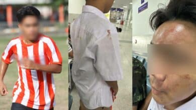เด็กม 4 โควตานักบอล ถูกเพื่อนแกล้งในโรงเรียน