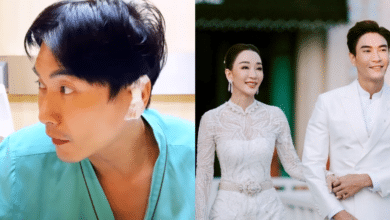 มาวิน - ตู่ โพสต์เตือน คนชอบแกะสิว ระวังโดนผ่าหู