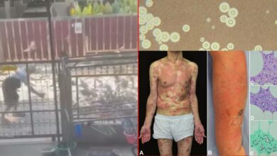 เชื้อรามูลนก ลุงเลี้ยงนกพิราบ