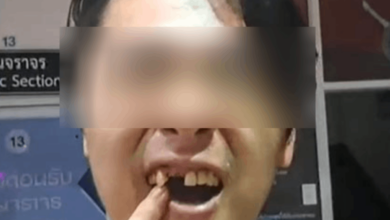 เตะชายเกาหลีฟันหัก