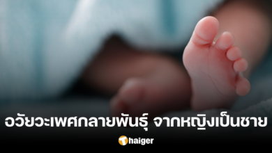 เหลือเชื่อ! ทารกหญิง วัย 2 เดือน น้ำหนักไม่เพิ่ม อวัยวะกลายพันธุ์ จากหญิงเป็นชาย