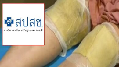 สปสช บริการพอกเข่า