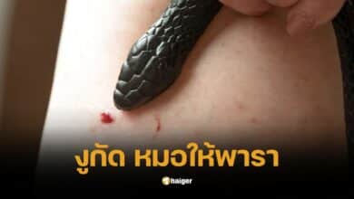 หนุ่มถูกงูกัด หมอให้พารา