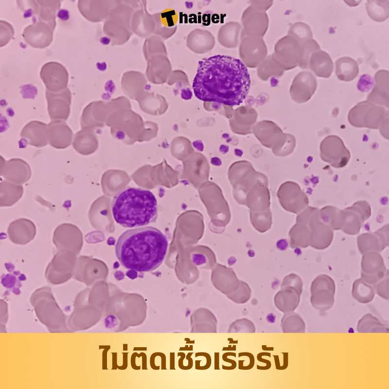 คนมีภูมิคุ้มกันมะเร็งไม่ติดเชื้อเรื้อรัง