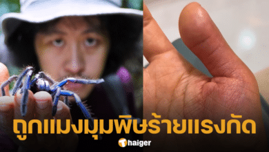 โจโฉ ยูทูบเบอร์ชื่อดังสายป่า ถูกแมงมุมทารันทูล่ากัด