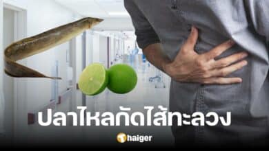 หนุ่มปวดท้องรุนแรง ลำไส้ถูกกัดทะลวง หมอตรวจเจอปลาไหล มะนาวในรูทวาร