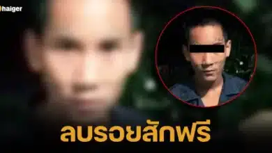 A famous clinic offers to help a 16-year-old boy get a giant facial tattoo removed for free. Hoping to start a new life