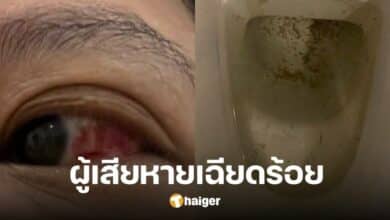 Condo residents complain that they found parasites in the water. Causes red eye infection Nearly a hundred victims