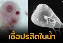 Get to know parasites in water, what is a silent danger nearby What is it through which they are transmitted