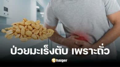 คนชอบกินถั่วต้องระวัง หมอยกเคส &#039;ป่วยมะเร็งตับ&#039; สาเหตุเพราะกินของว่างชนิดนี้